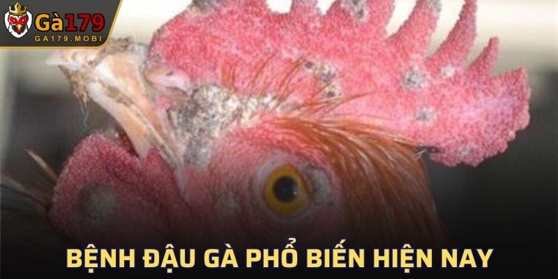 Bệnh Đậu Gà